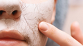 Why Your Skin Still Feels Dry After Using Lotion (And How Body Butter Fixes It)