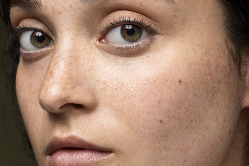 Can Body Scrubs Help with Dark Patches and Uneven Skin Tone?